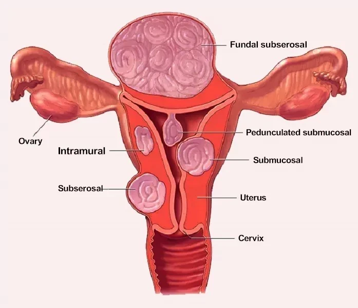 Best Gynecologist and Laparoscopic Surgeon in Shaikpet, Hyderabad